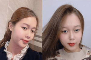 dam-dang-them-thuong-duoc-bu-bim